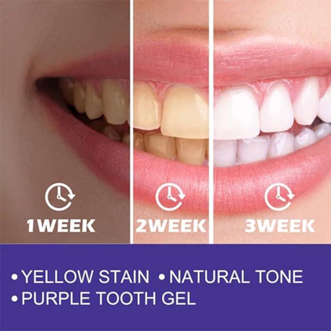 Purple Whitening Toothpaste - Image 5